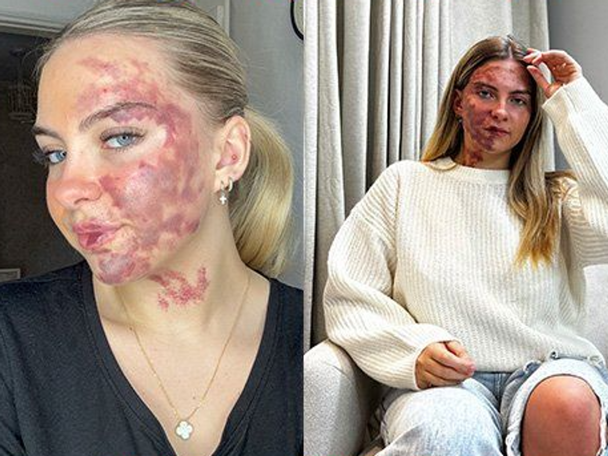 Beyond Skin Deep: Nancy Morel on living with an undiagnosed skin condition