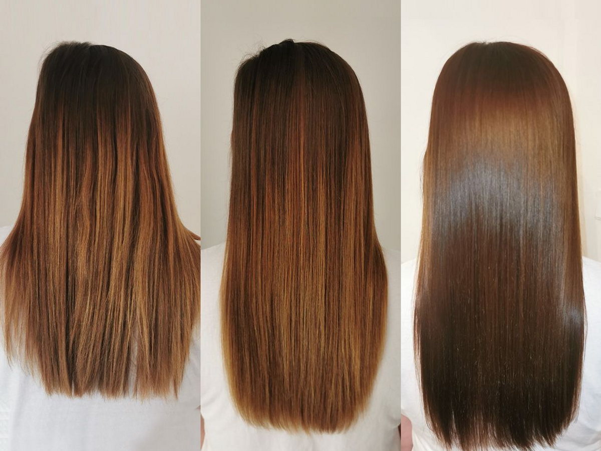 Hairburst 6 month results