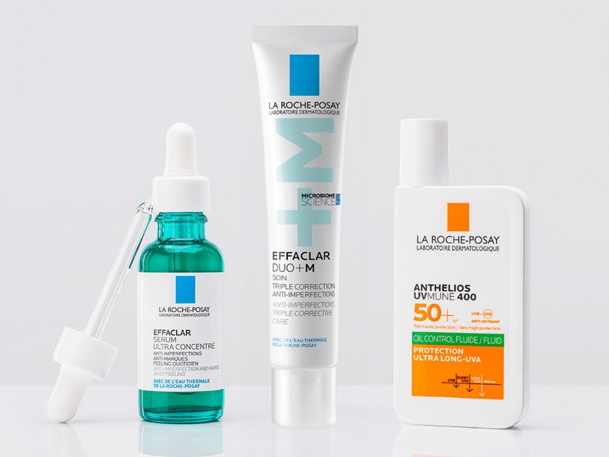 What are blackheads?