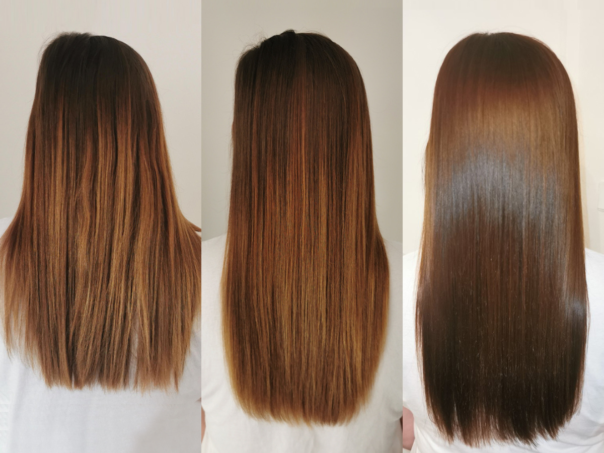 Hairburst 6 month results