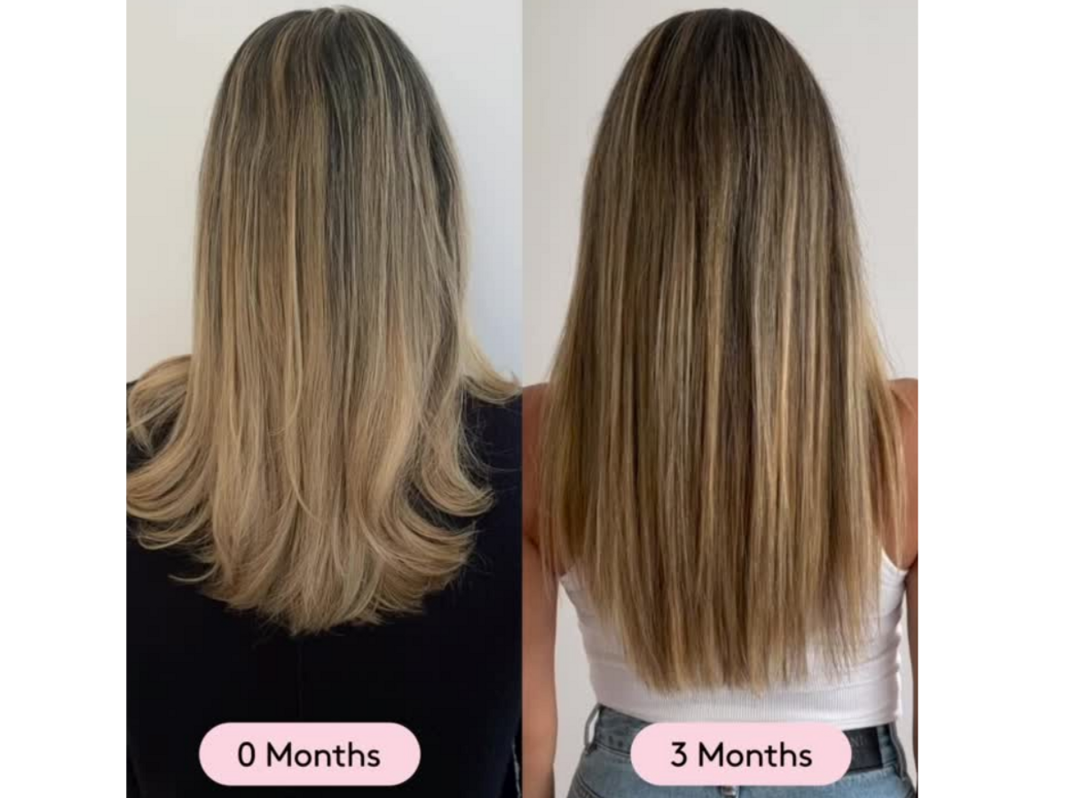 Before and After 3 month Results 🙌